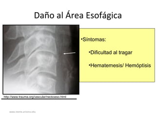 www.reeme.arizona.edu
Daño al Área Esofágica
•Síntomas:
•Dificultad al tragar
•Hematemesis/ Hemóptisis
http://www.trauma.org/vascular/neckoeso.html
 