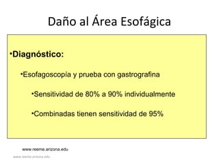 www.reeme.arizona.edu
Daño al Área Esofágica
•Diagnóstico:
•Esofagoscopía y prueba con gastrografina
•Sensitividad de 80% a 90% individualmente
•Combinadas tienen sensitividad de 95%
www.reeme.arizona.edu
 