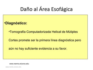 www.reeme.arizona.edu
Daño al Área Esofágica
•Diagnóstico:
•Tomografía Computadorizada Helical de Mútiples
Cortes promete ser la primera línea diagnóstica pero
aún no hay suficiente evidencia a su favor.
www.reeme.arizona.edu
 