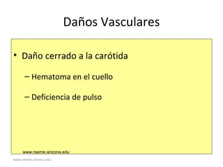 www.reeme.arizona.edu
Daños Vasculares
• Daño cerrado a la carótida
– Hematoma en el cuello
– Deficiencia de pulso
www.reeme.arizona.edu
 
