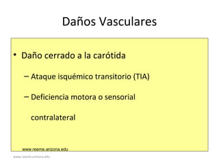 www.reeme.arizona.edu
Daños Vasculares
• Daño cerrado a la carótida
– Ataque isquémico transitorio (TIA)
– Deficiencia motora o sensorial
contralateral
www.reeme.arizona.edu
 