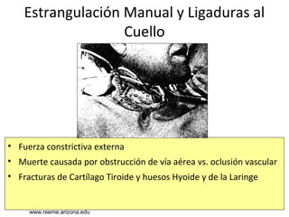 www.reeme.arizona.edu
Estrangulación Manual y Ligaduras al
Cuello
• Fuerza constrictiva externa
• Muerte causada por obstrucción de vía aérea vs. oclusión vascular
• Fracturas de Cartílago Tiroide y huesos Hyoide y de la Laringe
www.reeme.arizona.edu
 