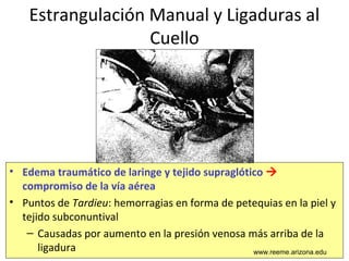 www.reeme.arizona.edu
Estrangulación Manual y Ligaduras al
Cuello
• Edema traumático de laringe y tejido supraglótico 
compromiso de la vía aérea
• Puntos de Tardieu: hemorragias en forma de petequias en la piel y
tejido subconuntival
– Causadas por aumento en la presión venosa más arriba de la
ligadura www.reeme.arizona.edu
 