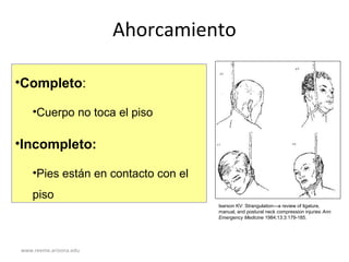 www.reeme.arizona.edu
Ahorcamiento
•Completo:
•Cuerpo no toca el piso
•Incompleto:
•Pies están en contacto con el
piso
Iserson KV: Strangulation—a review of ligature,
manual, and postural neck compression injuries Ann
Emergency Medicine 1984;13:3:179-185.
 