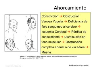 www.reeme.arizona.edu
Ahorcamiento
Constricción  Obstrucción
Venosa Yugular  Deficiencia de
flujo sanguíneo al cerebro 
Isquemia Cerebral  Pérdida de
conocimiento  Disminución en
tono muscular  Obstrucción
completa arterial o de vía aérea 
Muerte
www.reeme.arizona.edu
Iserson KV: Strangulation—a review of ligature, manual, and postural neck compression injuries Ann
Emergency Medicine 1984;13:3:179-185.
 