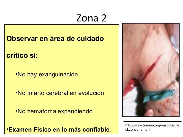 Hematoma Retrocorial Y Síndrome De Down