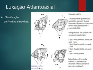 Luxação Atlantoaxial
 Classificação
de Fielding e Hawkins
 