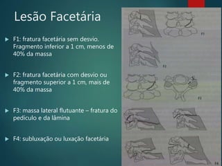 Lesão Facetária
 F1: fratura facetária sem desvio.
Fragmento inferior a 1 cm, menos de
40% da massa
 F2: fratura facetária com desvio ou
fragmento superior a 1 cm, mais de
40% da massa
 F3: massa lateral flutuante – fratura do
pedículo e da lâmina
 F4: subluxação ou luxação facetária
 