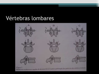 Vértebras lombares
 