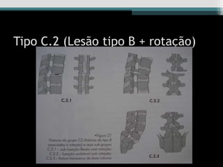 Tipo C.2 (Lesão tipo B + rotação)
 