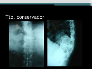 Tto. conservador
 