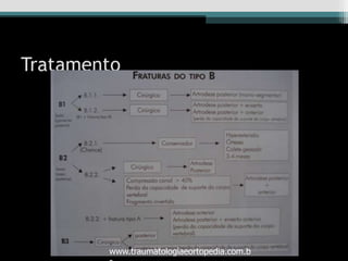 Tratamento
www.traumatologiaeortopedia.com.b
 