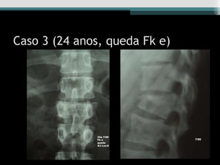 Caso 3 (24 anos, queda Fk e)
 