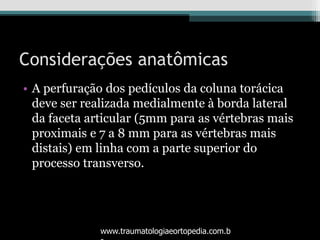 Considerações anatômicas
• A perfuração dos pedículos da coluna torácica
deve ser realizada medialmente à borda lateral
da faceta articular (5mm para as vértebras mais
proximais e 7 a 8 mm para as vértebras mais
distais) em linha com a parte superior do
processo transverso.
www.traumatologiaeortopedia.com.b
 
