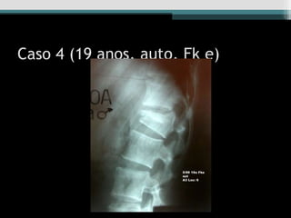 Caso 4 (19 anos, auto, Fk e)
 