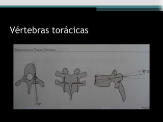 Vértebras torácicas
 