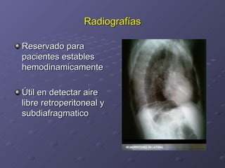 Radiografías Reservado para pacientes estables hemodinamicamente Útil en detectar aire libre retroperitoneal y subdiafragmatico 