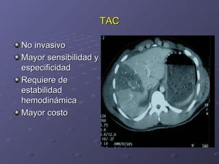 TAC No invasivo Mayor sensibilidad y especificidad Requiere de estabilidad hemodinámica Mayor costo 