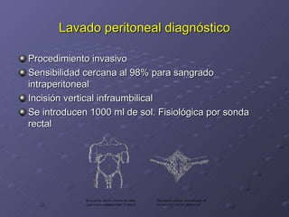 Lavado peritoneal diagnóstico Procedimiento invasivo Sensibilidad cercana al 98% para sangrado intraperitoneal Incisión vertical infraumbilical Se introducen 1000 ml de sol. Fisiológica por sonda rectal 
