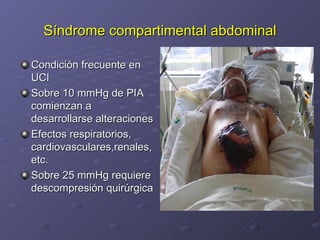 Síndrome compartimental abdominal Condición frecuente en UCI Sobre 10 mmHg de PIA comienzan a desarrollarse alteraciones Efectos respiratorios, cardiovasculares,renales,etc. Sobre 25 mmHg requiere descompresión quirúrgica 
