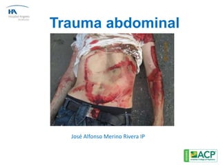 Trauma abdominal
José Alfonso Merino Rivera IP
 