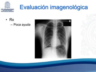 Evaluación imagenológica

• Rx
  – Poca ayuda
 