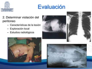 Evaluación
2. Determinar violación del
peritoneo
   – Características de la lesión
   – Exploración local
   – Estudios radiológicos
 