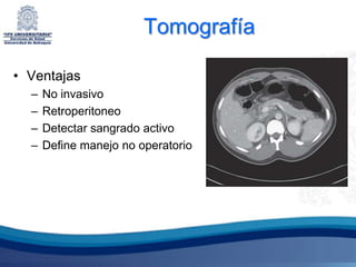 Tomografía

• Ventajas
  –   No invasivo
  –   Retroperitoneo
  –   Detectar sangrado activo
  –   Define manejo no operatorio
 