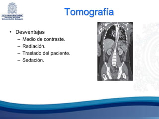 Tomografía
• Desventajas
  –   Medio de contraste.
  –   Radiación.
  –   Traslado del paciente.
  –   Sedación.
 