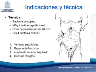 Indicaciones y técnica
• Técnica
  –    Paciente en supino
  –    Máquina de ecografía móvil.
  –    Onda de penetración de 20 cms
  –    Los 4 puntos a evaluar



  1.    Ventana subxifoidea.
  2.    Espacio de Morrison.
  3.    cuadrante superior izquierdo.
  4.    Saco de Douglas.



                                        RadioGraphics 2008; 28:225–244
 