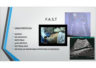 F.A.S.T
• CARACTERÍSTICAS:
• RAPIDO
• NO INVASIVO
• REPETIBLE
• 97%CERTEZA
• NOTRASLADO
• NO EVALUA DIAFRAGMA INTESTINO O PANCREAS
 