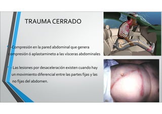 TRAUMA CERRADO
• -Compresión en la pared abdominal que genera
compresión ó aplastamineto a las vísceras abdominales
• - Las lesiones por desaceleración existen cuando hay
un movimiento diferencial entre las partes fijas y las
no fijas del abdomen.
 