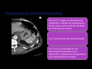 TOMOGRAFÍA COMPUTARIZADA
Con la CT se logra un alto grado de
resolución y detalle del parénquima,
de los vasos y de la relación del bazo
con estructuras vecinas.
La CT actual está más automatizada,
La CT se ha convertido en una
herramienta invaluable en la
valoración y tratamiento del paciente
con traumatismos cerrados,
 