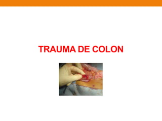 TRAUMA DE COLON
 