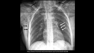 http://www.intramed.net/contenidover.asp?contenidoID=82598
 