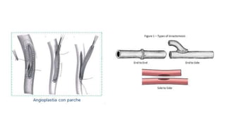 Trauma de Cuello - Anatomía de Cuello - Anatomia de Cuello