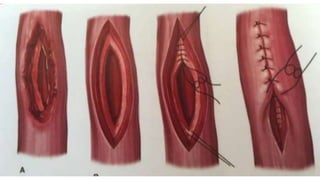 Trauma de Cuello - Anatomía de Cuello - Anatomia de Cuello