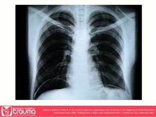 Fakhry S, Watts D, Daley B, et al.: Current diagnostic approaches lack sensitivity in the diagnosis of perforating blunt 
small bowel injury (SBI): Findings from a large multi-institutional trial. J Trauma 51:1232, (abstract) 2001. 
 