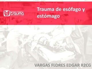 Trauma de esófago y 
estómago 
VARGAS FLORES EDGAR R2CG 
 