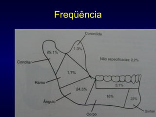 Freqüência 