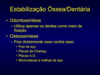 Estabilização Óssea/Dentária Odontossíntese Utiliza apenas os dentes como meio de fixação Osteossíntese Fixa diretamente osso contra osso Fios de aço Placas de Champy Placas A.O. Micro-placas e malhas de aço 