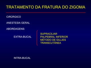 TRATAMENTO DA FRATURA DO ZIGOMA CIRÚRGICO ANESTESIA GERAL ABORDAGENS:  EXTRA-BUCAL INTRA-BUCAL SUPRACILIAR PALPEBRAL INFERIOR MÉTODO DE GILLIES TRANSCUTÂNEA 