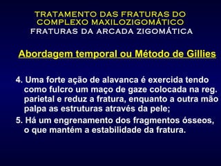 TRATAMENTO DAS FRATURAS DO COMPLEXO MAXILOZIGOMÁTICO   fraturas da arcada zigomática Abordagem temporal ou Método de Gillies 4. Uma forte ação de alavanca é exercida tendo como fulcro um maço de gaze colocada na reg. parietal e reduz a fratura, enquanto a outra mão palpa as estruturas através da pele; 5. Há um engrenamento dos fragmentos ósseos, o que mantém a estabilidade da fratura. 