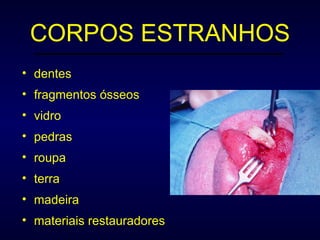 CORPOS ESTRANHOS dentes fragmentos ósseos vidro pedras  roupa  terra  madeira materiais restauradores 