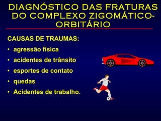 DIAGNÓSTICO DAS FRATURAS DO COMPLEXO ZIGOMÁTICO-ORBITÁRIO CAUSAS DE TRAUMAS: agressão física acidentes de trânsito esportes de contato quedas  Acidentes de trabalho. 