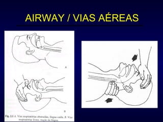 AIRWAY / VIAS AÉREAS 