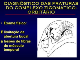 DIAGNÓSTICO DAS FRATURAS DO COMPLEXO ZIGOMÁTICO-ORBITÁRIO Exame físico:     limitação da abertura bucal    lesões de fibras do músculo temporal 