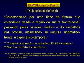 FRATURA tipo Le Fort III: (Disjunção crâniofacial) “ Caracteriza-se por uma linha de fratura que estende-se desde a região da sutura fronto-nasal, passando pelas paredes mediais e do assoalhos das órbitas, alcançando as suturas zigomático-frontal e zigomático-temporal.”   * Completa separação do esqueleto facial e craniano; * Não é uma fratura crâniofacial. CRUZ, Ricardo L.; COSTA, Edgar A. Fraturas de maxila,  In : PSILAKIS, J.M.; ZANINI, S.A.; MÉLEGA, J.M.; CRUZ, R.L. Cirurgia Craniomaxilofacial: Osteotomias Estéticas da Face. RIO DE JANEIRO: MEDSI, p.515-534, 1987. 