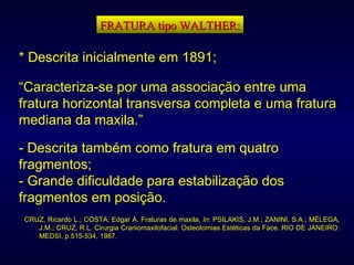 FRATURA tipo WALTHER: * Descrita inicialmente em 1891; “ Caracteriza-se por uma associação entre uma fratura horizontal transversa completa e uma fratura mediana da maxila.” - Descrita também como fratura em quatro fragmentos; - Grande dificuldade para estabilização dos fragmentos em posição. CRUZ, Ricardo L.; COSTA, Edgar A. Fraturas de maxila,  In : PSILAKIS, J.M.; ZANINI, S.A.; MÉLEGA, J.M.; CRUZ, R.L. Cirurgia Craniomaxilofacial: Osteotomias Estéticas da Face. RIO DE JANEIRO: MEDSI, p.515-534, 1987. 
