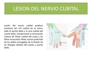 LESION DEL NERVIO CUBITAL
Lesión del nervio cubital produce
anestesia del 1/3 cubital de la mano,
todo el quinto dedo y la cara cubital del
cuarto dedo. Compromete la innervación
motora de Flexor cubital del carpo y las
fibras musculares flexor común profundo
de los dedos encargadas de la flexión de
las falanges dístales del cuarto y quinto
dedo.
 